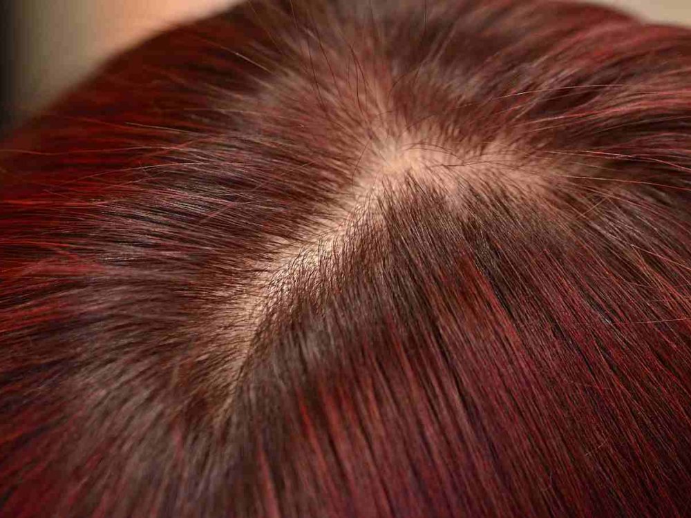 TRATTAMENTI CUTE SANA PADOVA